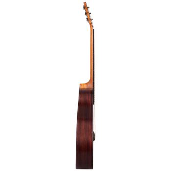 Preview: Kremona R35E Akustikgitarre mit L-R-Baggs Pickup, Orchestra Form, Fichte Palisander, vollmassiv, Zarge